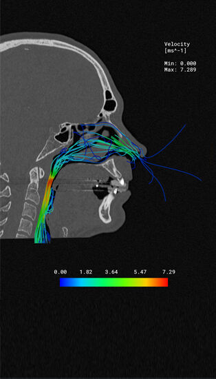 Simulation & Testing for Medical Devices